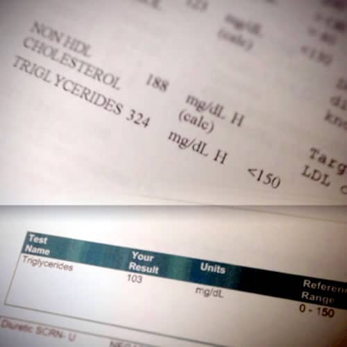 Jamey Bennett Cholesterol Tests